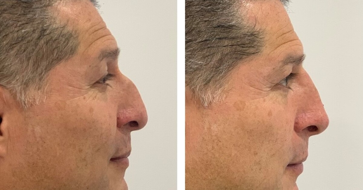 Mitos sobre la estética facial para hombres