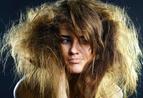 El síndrome del cabello despeinable es poco conocido.
