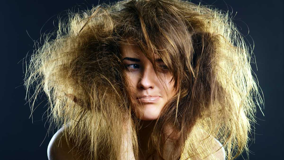 El síndrome del cabello despeinable es poco conocido.
