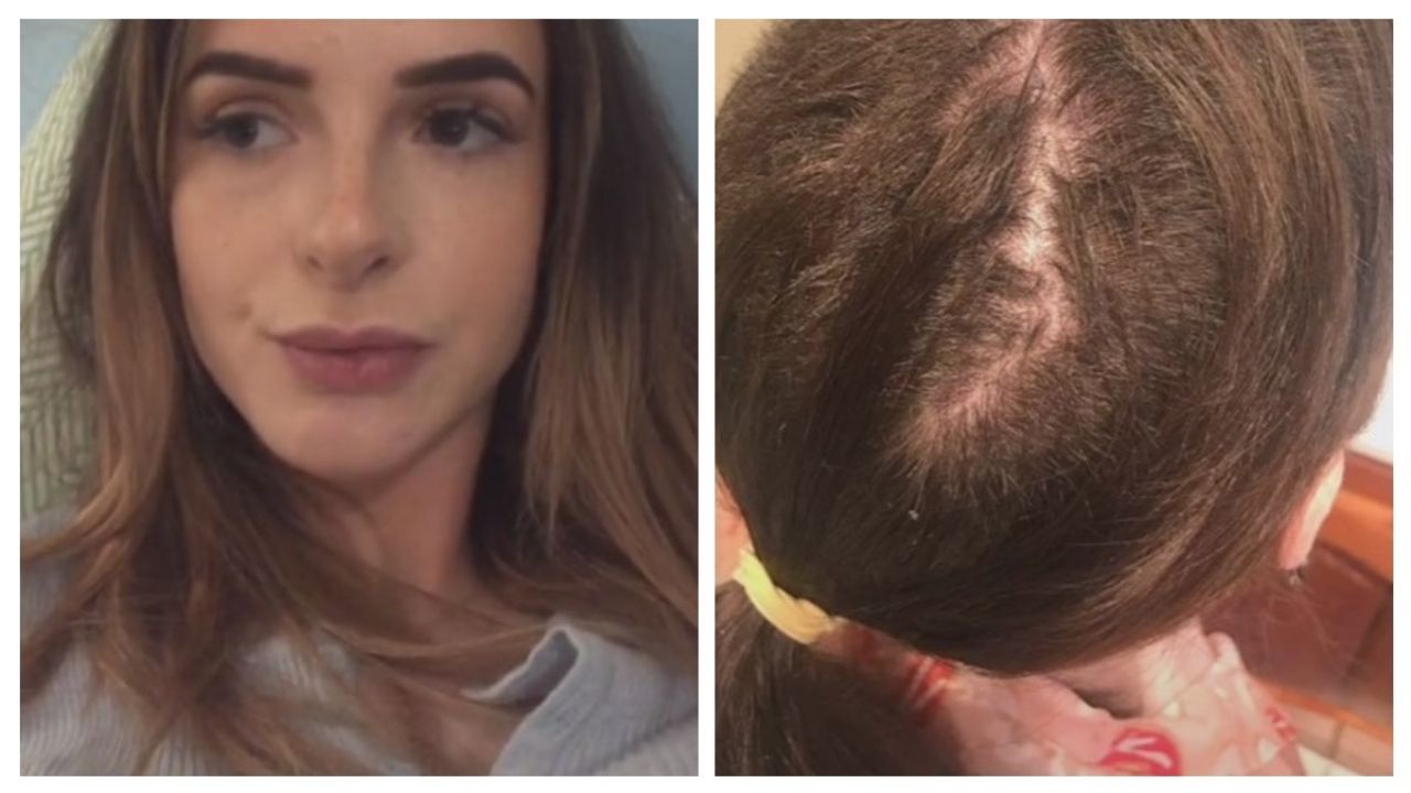 Una joven se hace un cambio de look y el estilista la deja sin la mitad de su cabello