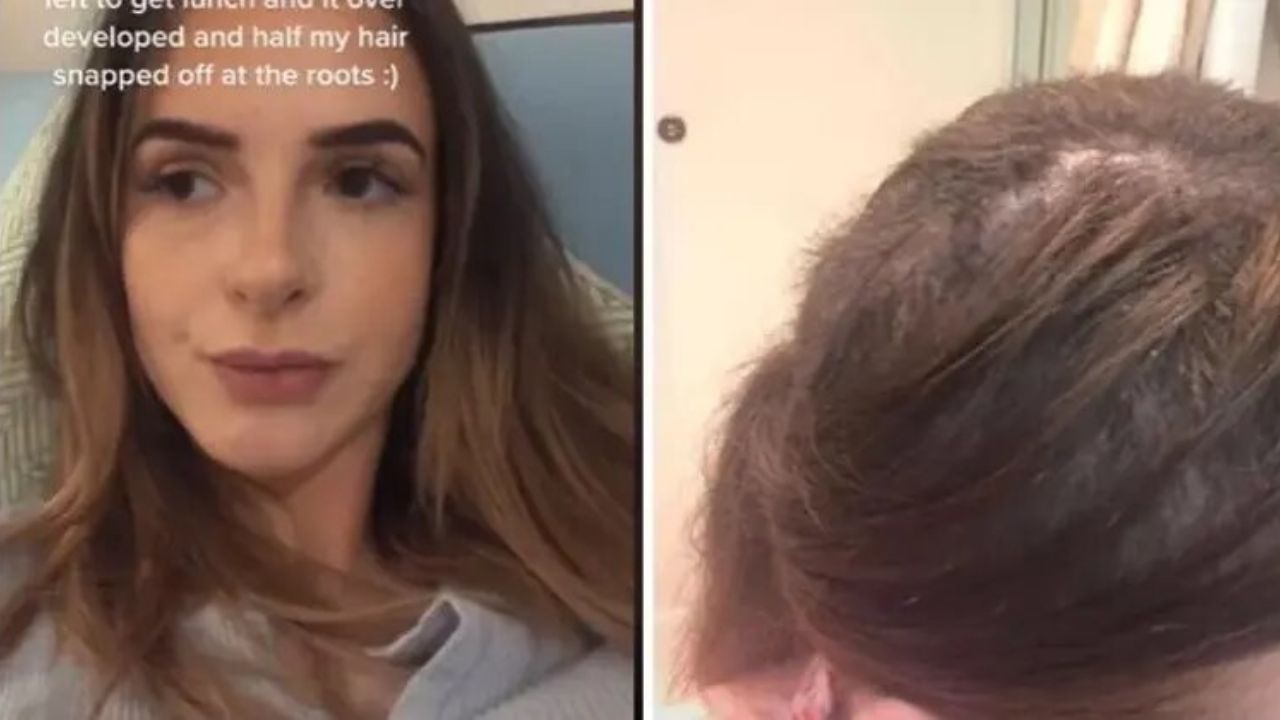 VIDEO: El alisado químico sale mal y mujer pierde parte de su cabello