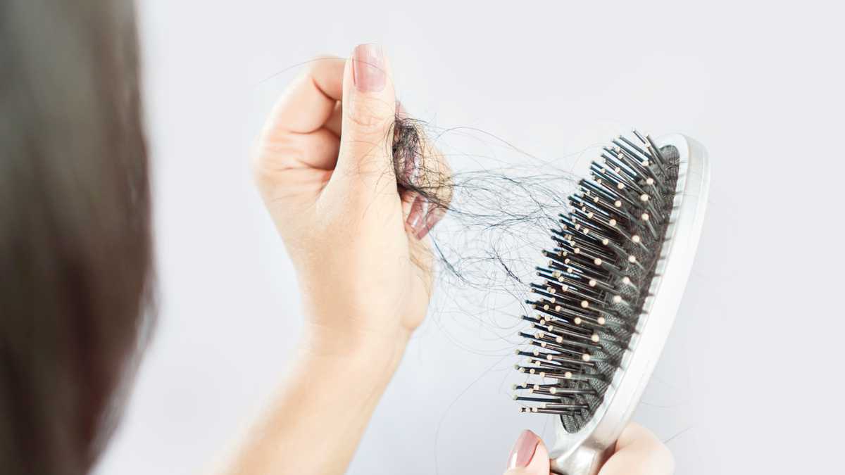 La caída del cabello puede tener varias causas.