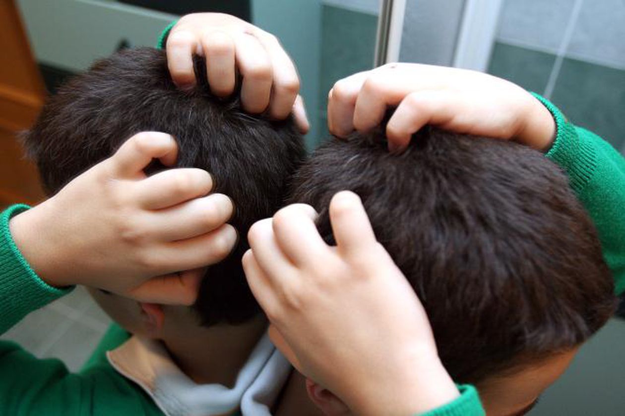 ni vinagre ni aceites esenciales, estos son los tratamientos más efectivos