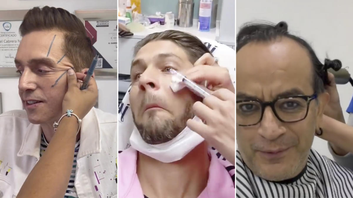 Los impresionantes tratamientos estéticos que utilizan las celebrities para lucir "jóvenes".