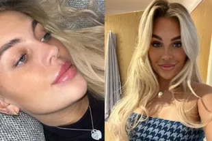 Después de unos días, el resultado del tratamiento hizo feliz a la Tiktokerin y a sus seguidores.