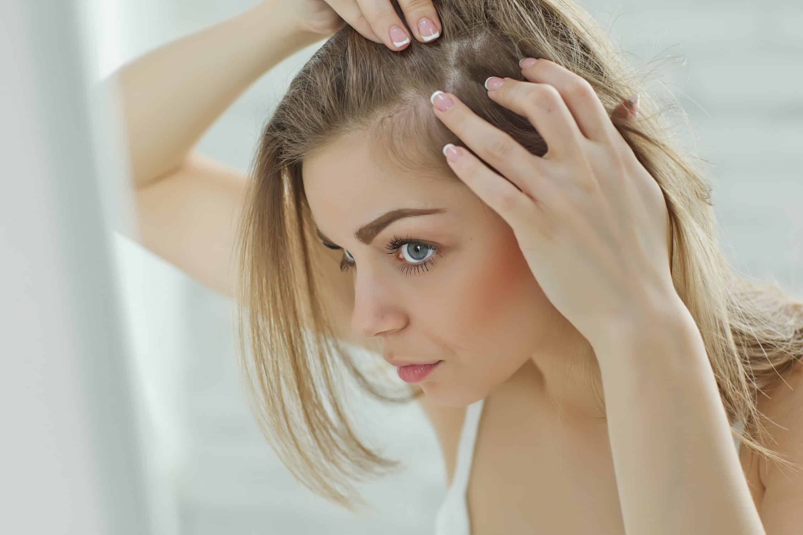 El estrés y su relación con la caída del cabello