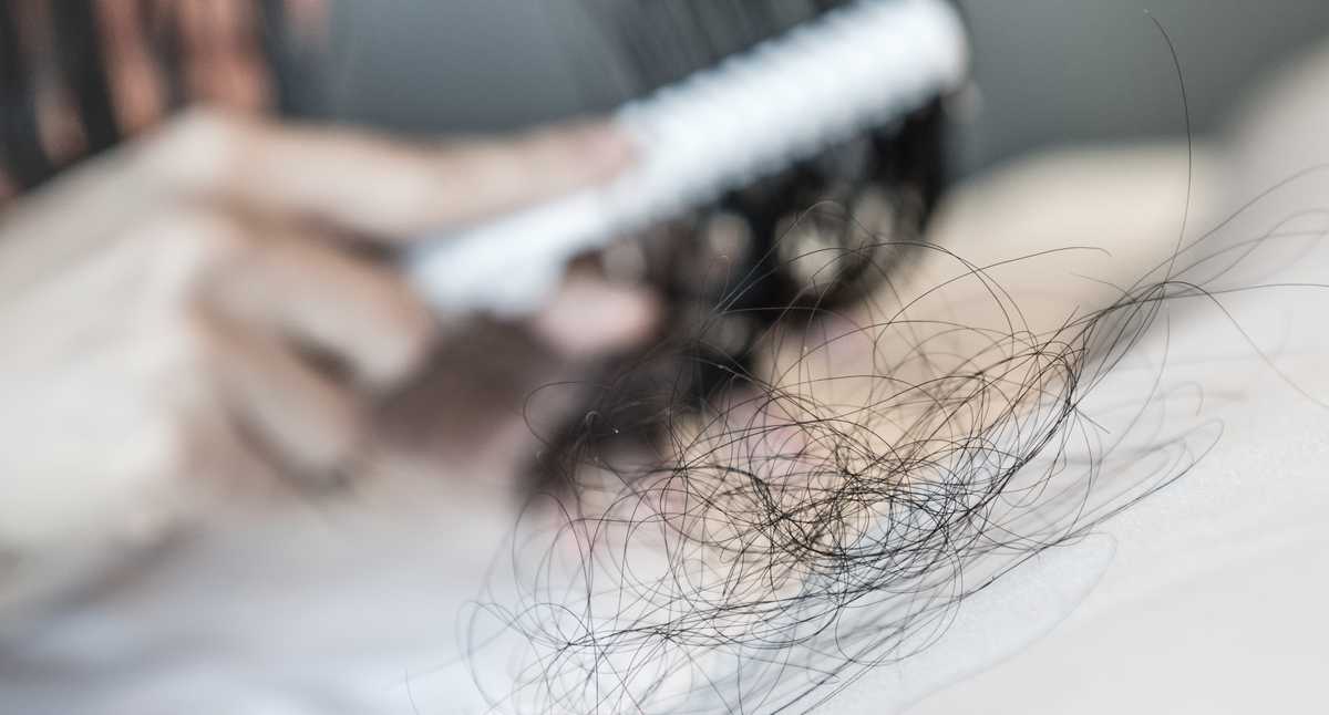 Ocho recomendaciones para prevenir la caída del cabello de forma natural