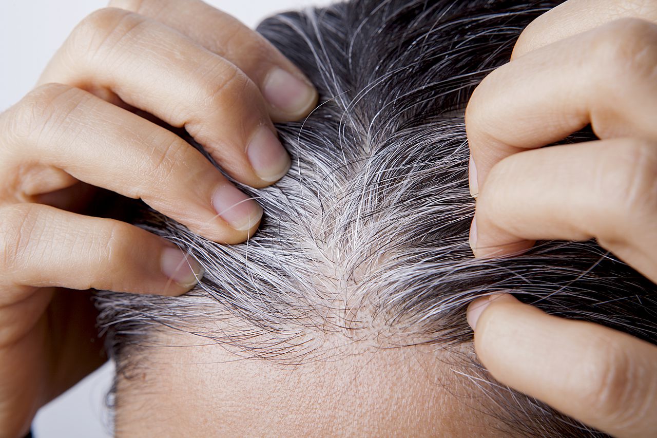 pelo blanco