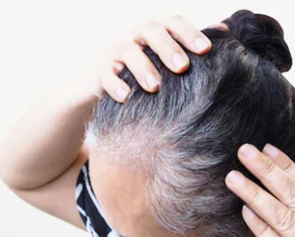 Una mujer con canas en la cabeza |  Fotografía de archivo